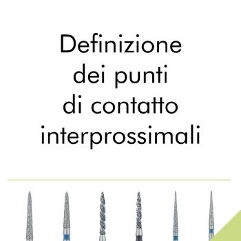 Definizione dei punti di contatto interprossimali
