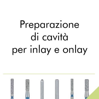 Preparazione di cavita' per inlay e onlay