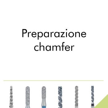 Preparazione chamfer
