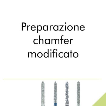 Preparazione chamfer modificata