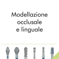 Modellazione occlusale e linguale