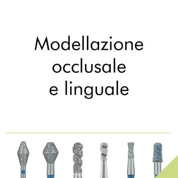 Modellazione occlusale e linguale