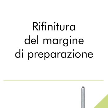 Rifinitura del margine di preparazione