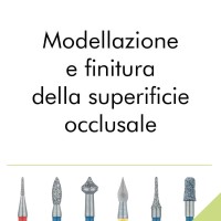 Modellazione e finitura della superificie occlusale