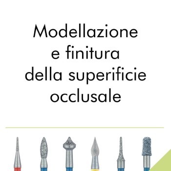 Modellazione e finitura della superificie occlusale