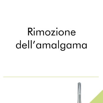 Rimozione dell'amalgama